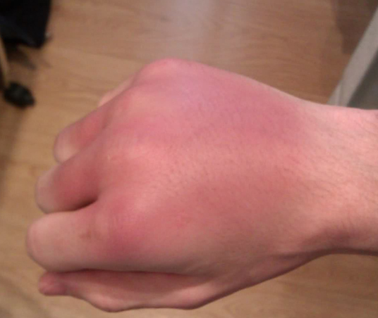 GOLPESENLAMANO